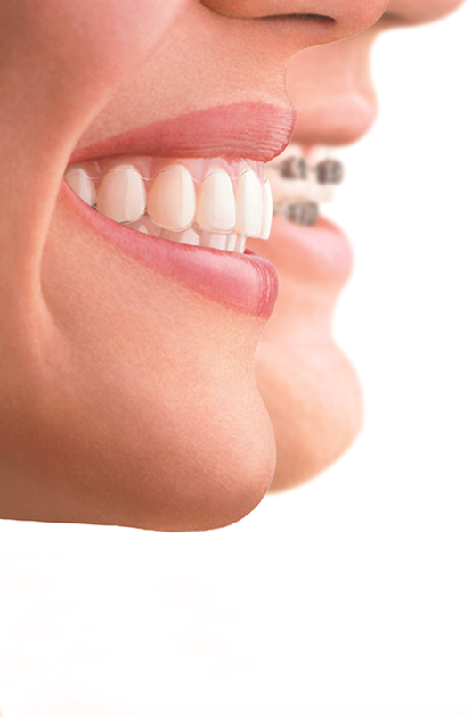 Ağız ve Çene Cerrahisi